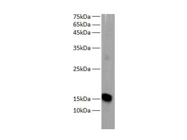MB Polyclonal Antibody (E-AB-40504)