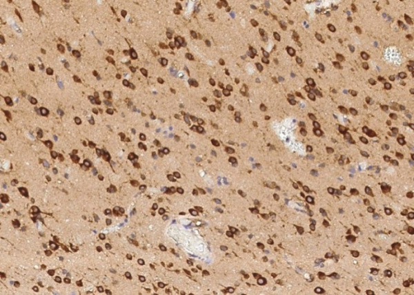 TLR2 (CD282) Monoclonal Antibody (AN200091P)