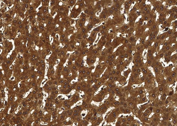 Coagulation Factor X/F10 Monoclonal Antibody (AN200202P)