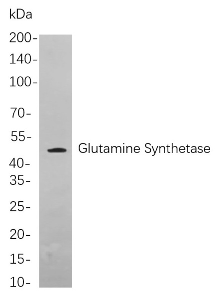 Recombinant Glutamine Synthetase Monoclonal Antibody (AN300986L)