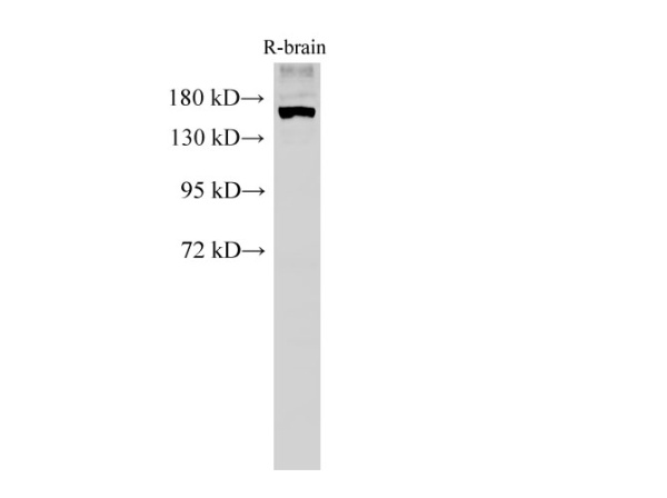 PARD3 Polyclonal Antibody (E-AB-40193)