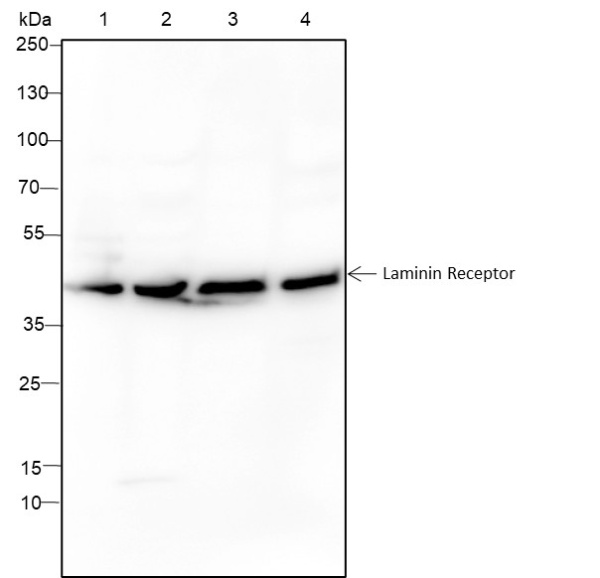 Recombinant Laminin Receptor Monoclonal Antibody (AN301586L)