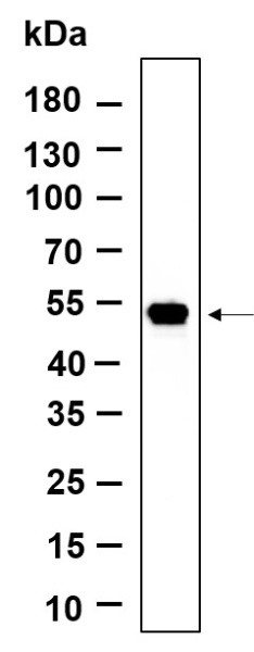 Recombinant LOX Monoclonal Antibody (AN301157L)