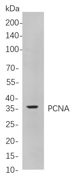 Recombinant PCNA Monoclonal Antibody (AN300996L)