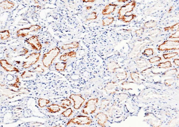 Recombinant Cystatin C/CST3 Monoclonal Antibody (AN300336P)