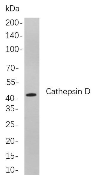 Recombinant Cathepsin D Monoclonal Antibody (AN301018L)