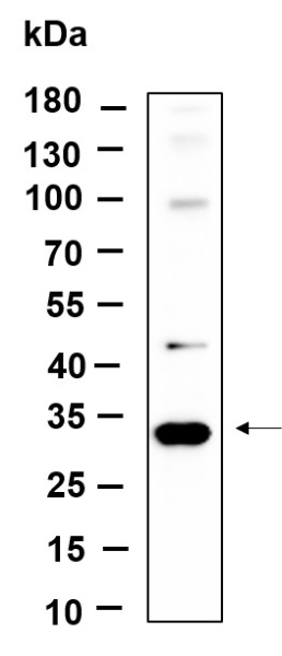 Recombinant Snail Monoclonal Antibody (AN301392L)