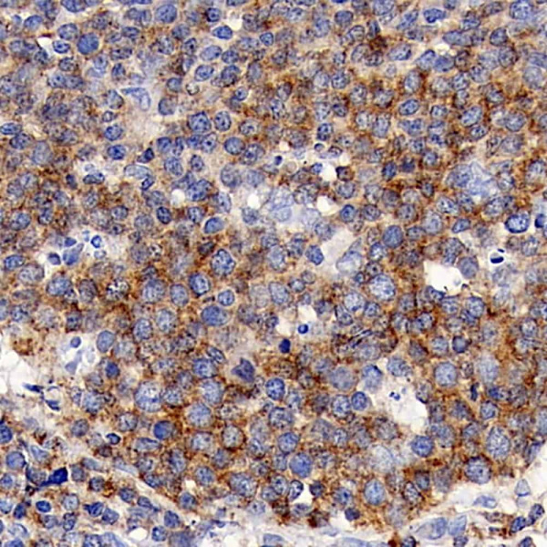 CD192 Polyclonal Antibody (E-AB-70194)