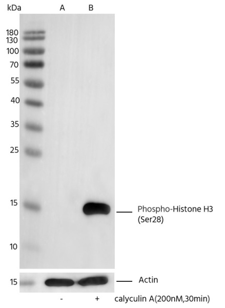 Recombinant Phospho-Histone H3 (Ser28) Monoclonal Antibody (AN300389L)