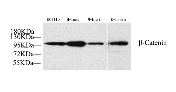 Catenin beta Polyclonal Antibody (E-AB-70005)