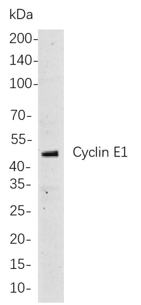 Recombinant Cyclin E1 Monoclonal Antibody (AN301091L)