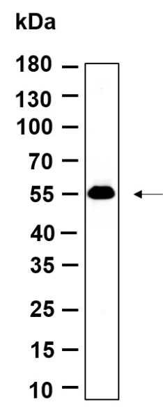 Recombinant p53 (Acetyl Lys382) Monoclonal Antibody (AN301167L)