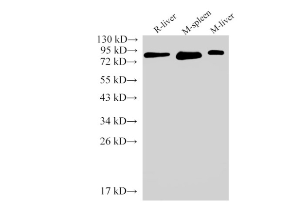 IL6R Polyclonal Antibody (E-AB-40344)