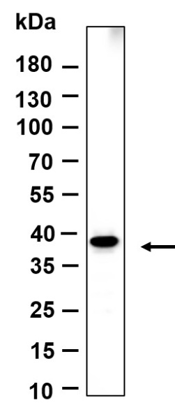 Recombinant Crk-L Monoclonal Antibody (AN301169L)