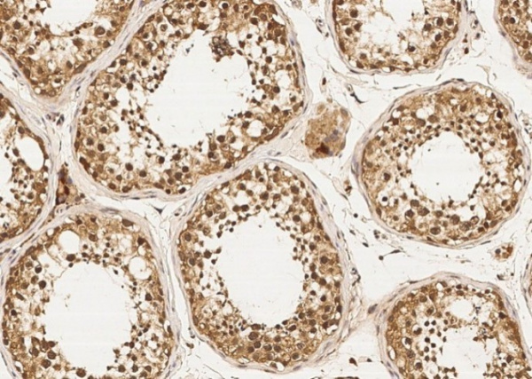 DZIP1 Monoclonal Antibody (AN200089P)