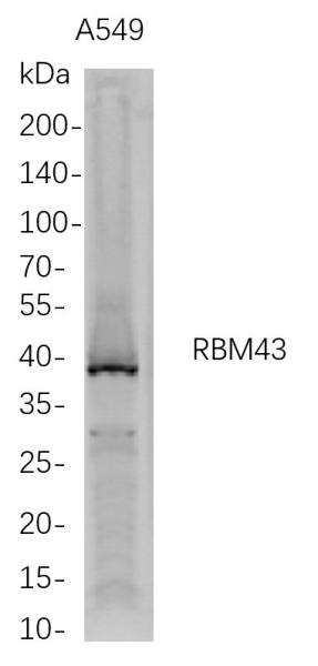 Recombinant RBM43 Monoclonal Antibody (AN300751L)