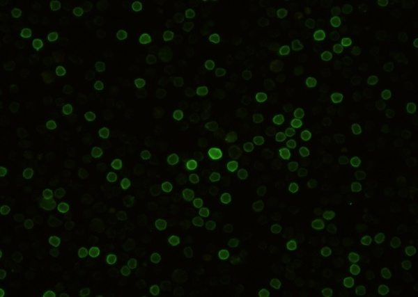 Recombinant CD27 Monoclonal Antibody (AN300476P)