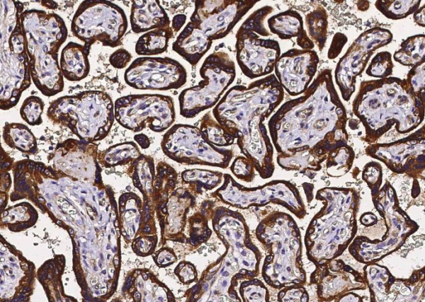 Recombinant TRAIL R4/CD264/TNFRSF10D Monoclonal Antibody (AN300333P)