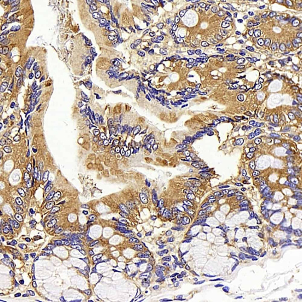 CD13 Polyclonal Antibody (E-AB-70224)