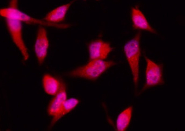 Recombinant 4E-BP1/EIF4EBP1 Monoclonal Antibody (AN300047P)