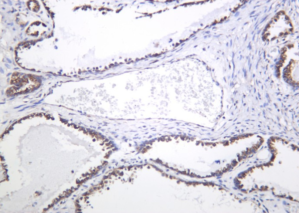 Recombinant DCLK1 Monoclonal Antibody (AN301283L)