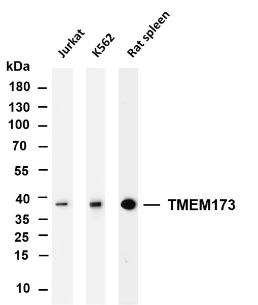 Recombinant TMEM173 Monoclonal Antibody (AN301084L)