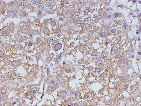 CA199 Polyclonal Antibody (D-AB-10468L)