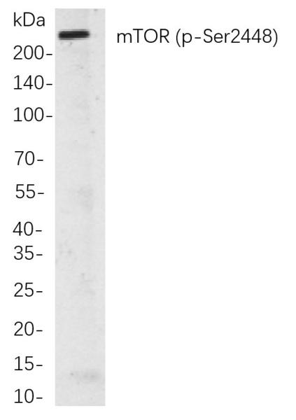 Recombinant Phospho-mTOR (Ser2448) Monoclonal Antibody (AN300852L)