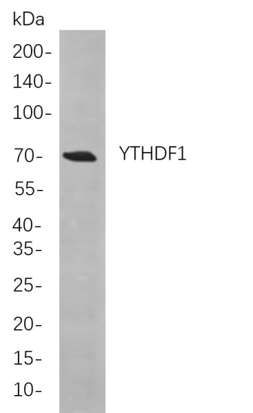 Recombinant YTHDF1 Monoclonal Antibody (AN301008L)