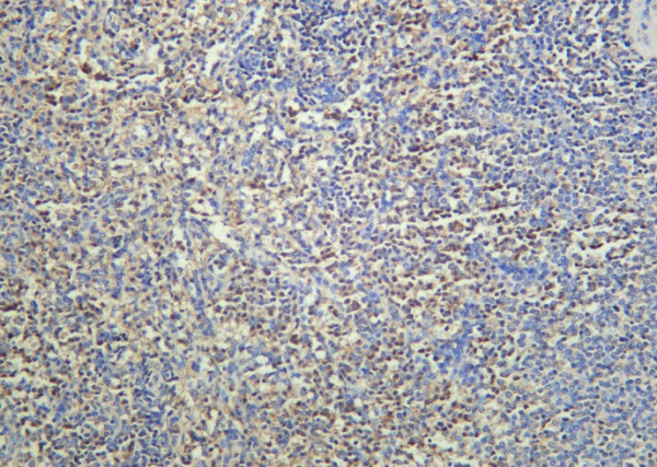 Recombinant cIAP2 Monoclonal Antibody (AN301179L)