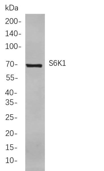 Recombinant S6K1 Monoclonal Antibody (AN300990L)