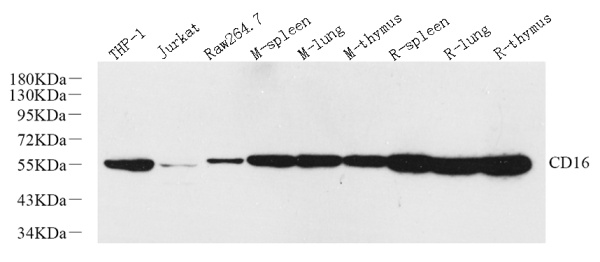 FCGR3A Polyclonal Antibody (E-AB-70305)