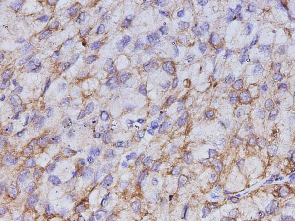 CK-7 Polyclonal Antibody (D-AB-10469L)