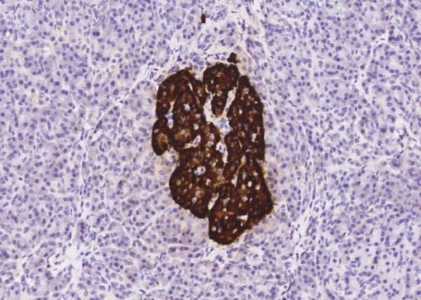 Recombinant Chromogranin A/CHGA/CGA Monoclonal Antibody (AN300072P)