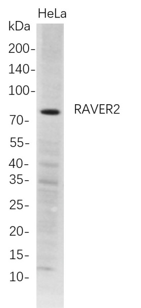 Recombinant RAVER2 Monoclonal Antibody (AN300757L)