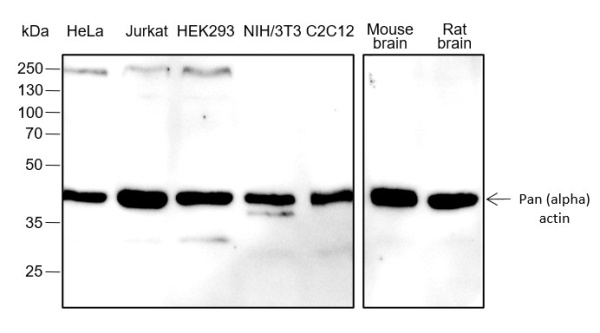 Recombinant Pan-Actin Monoclonal Antibody (AN301618L)