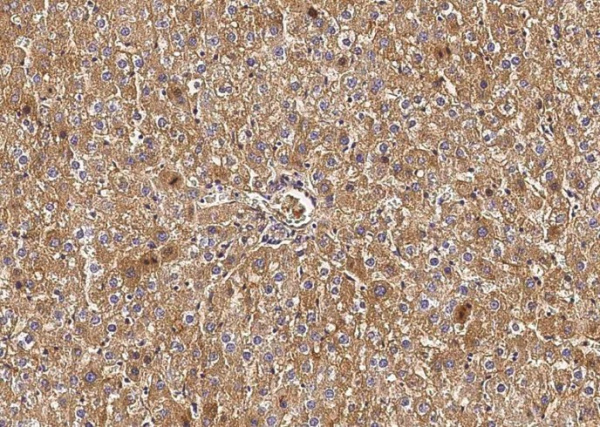 Transferrin/TF Monoclonal Antibody (AN200256P)