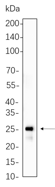Recombinant HSP27 Monoclonal Antibody (AN301310L)
