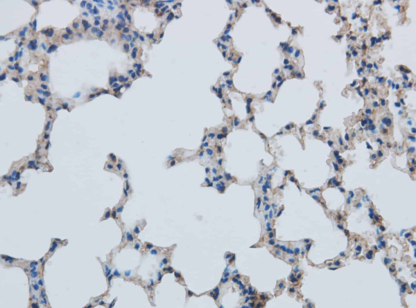MMP1 Polyclonal Antibody (E-AB-40152)