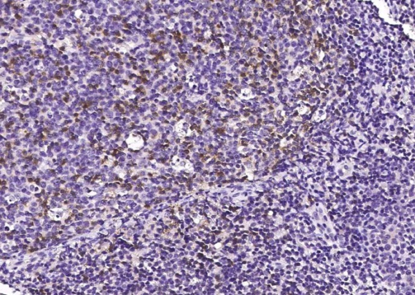 Recombinant PD1/PDCD1/CD279 Monoclonal Antibody (AN300329P)