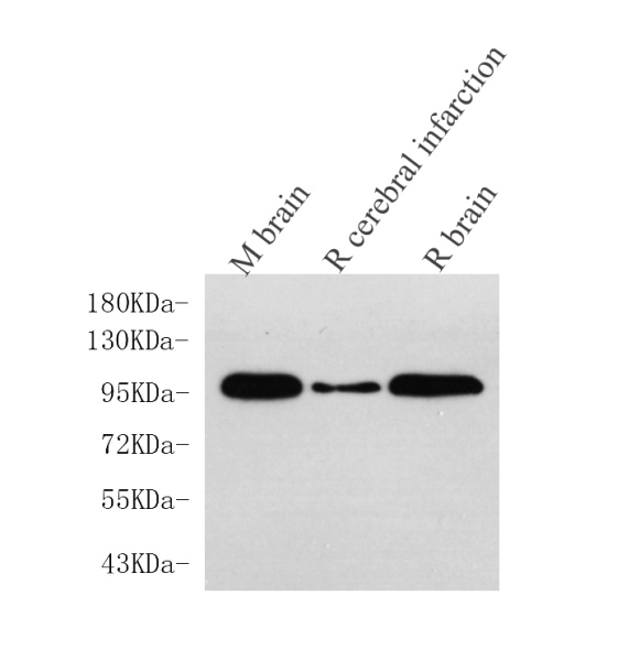DLG4 Polyclonal Antibody (E-AB-70135)