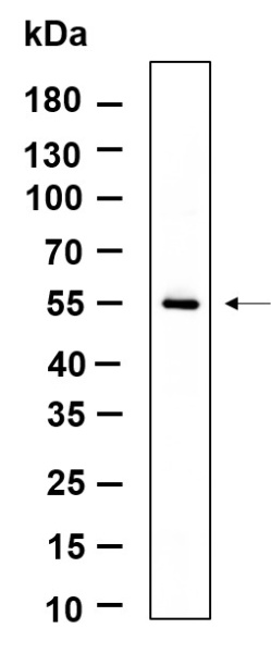 Recombinant TXNIP Monoclonal Antibody (AN301188L)