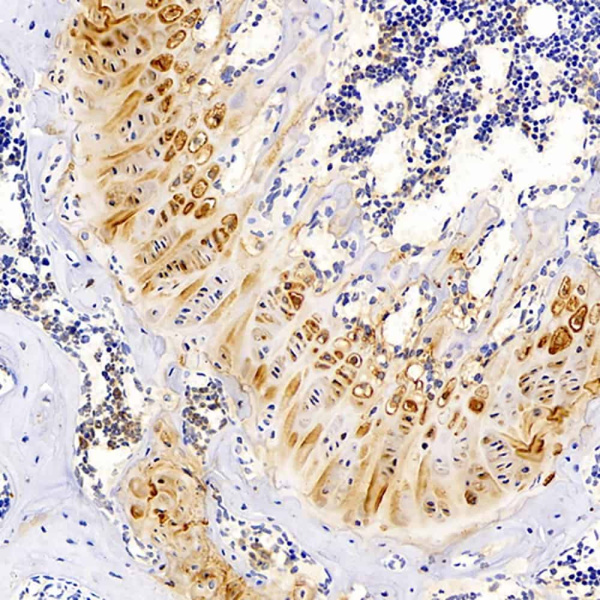 MAGEC1 Polyclonal Antibody (E-AB-70250)
