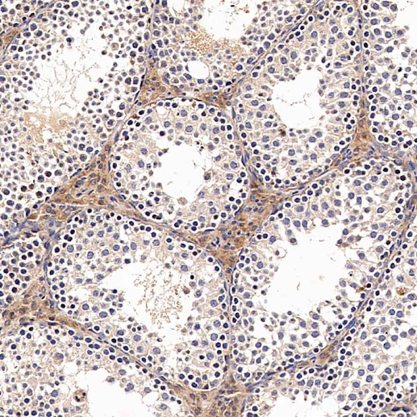 ACE1 Polyclonal Antibody (E-AB-70116)