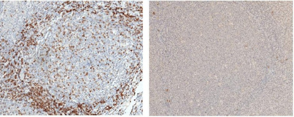 CD3d/CD3 delta Monoclonal Antibody (AN200113P)