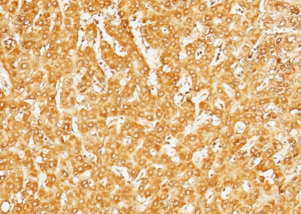 Recombinant SerpinD1 Monoclonal Antibody (AN300182P)