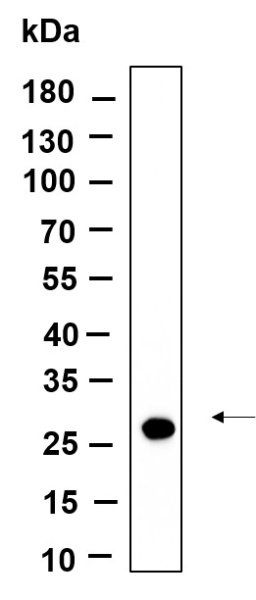 Recombinant CTRP2 Monoclonal Antibody (AN301207L)
