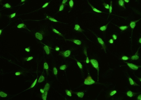 STK4/MST1 Monoclonal Antibody (AN200213P)
