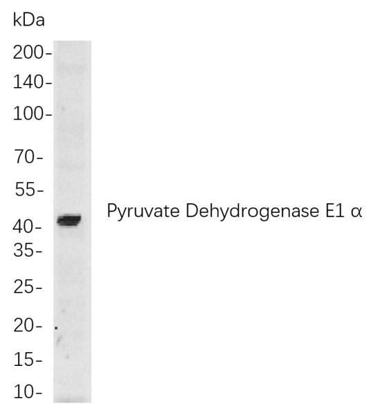 Recombinant Pyruvate Dehydrogenase E1 α Monoclonal Antibody (AN301007L)