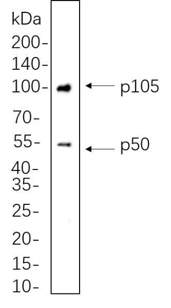 Recombinant NF-κB1 p105/p50 Monoclonal Antibody (AN301362L)